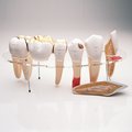 Denoyer-Geppert Anatomical Model, Dental Morphology Series 0114-00